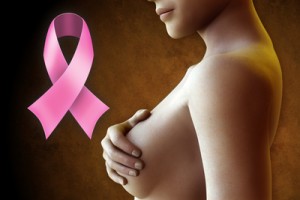 cáncer de mama, factores de riesgo, tipos de cáncer de mama, luminal A, luminal B, fenotipo basal, marcador molecular conocido como HER 2, células malignas, ejercicios relajantes, armonía en el interior, Trastuzumab, Capecitabina, Bevacizumab, mastografía, diagnóstico,