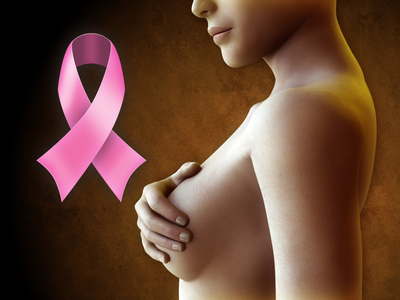 cáncer de mama, factores de riesgo, tipos de cáncer de mama, luminal A, luminal B, fenotipo basal, marcador molecular conocido como HER 2, células malignas, ejercicios relajantes, armonía en el interior, Trastuzumab, Capecitabina, Bevacizumab, mastografía, diagnóstico, 