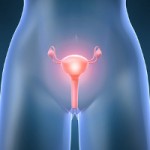 síntomas, tamaño grande de los ovarios, líquido en el abdomen, dolor en la pelvis, tratamiento, cáncer de ovario, fase inial, fase intermedia, fase avanzada.
