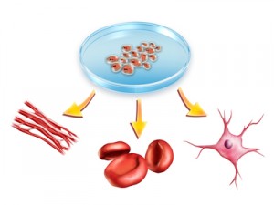 células madre, cordón umbilical, recién nacido, regenerar el sistema inmunológico, enfermedades inmunológicas, leucemia, línfomas,