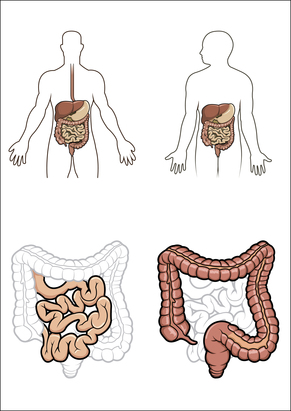 tipos de cáncer, síntomas tratamientos, cáncer del aparato digestivo