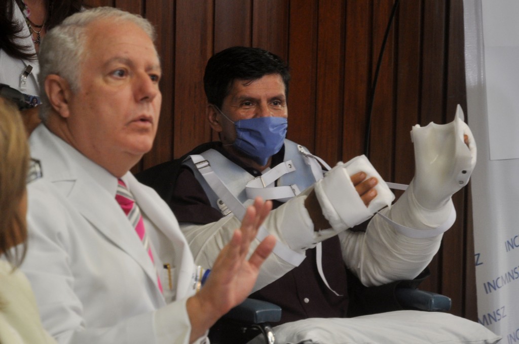 Exitoso trasplante de brazos se realizó en México