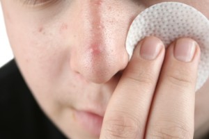 Datos del estudio “Juicios y percepciones psicosociales del adolescente con acné” realizado en Estados Unidos, da conocer la percepción que la sociedad tiene respecto a los adolescentes con acné.