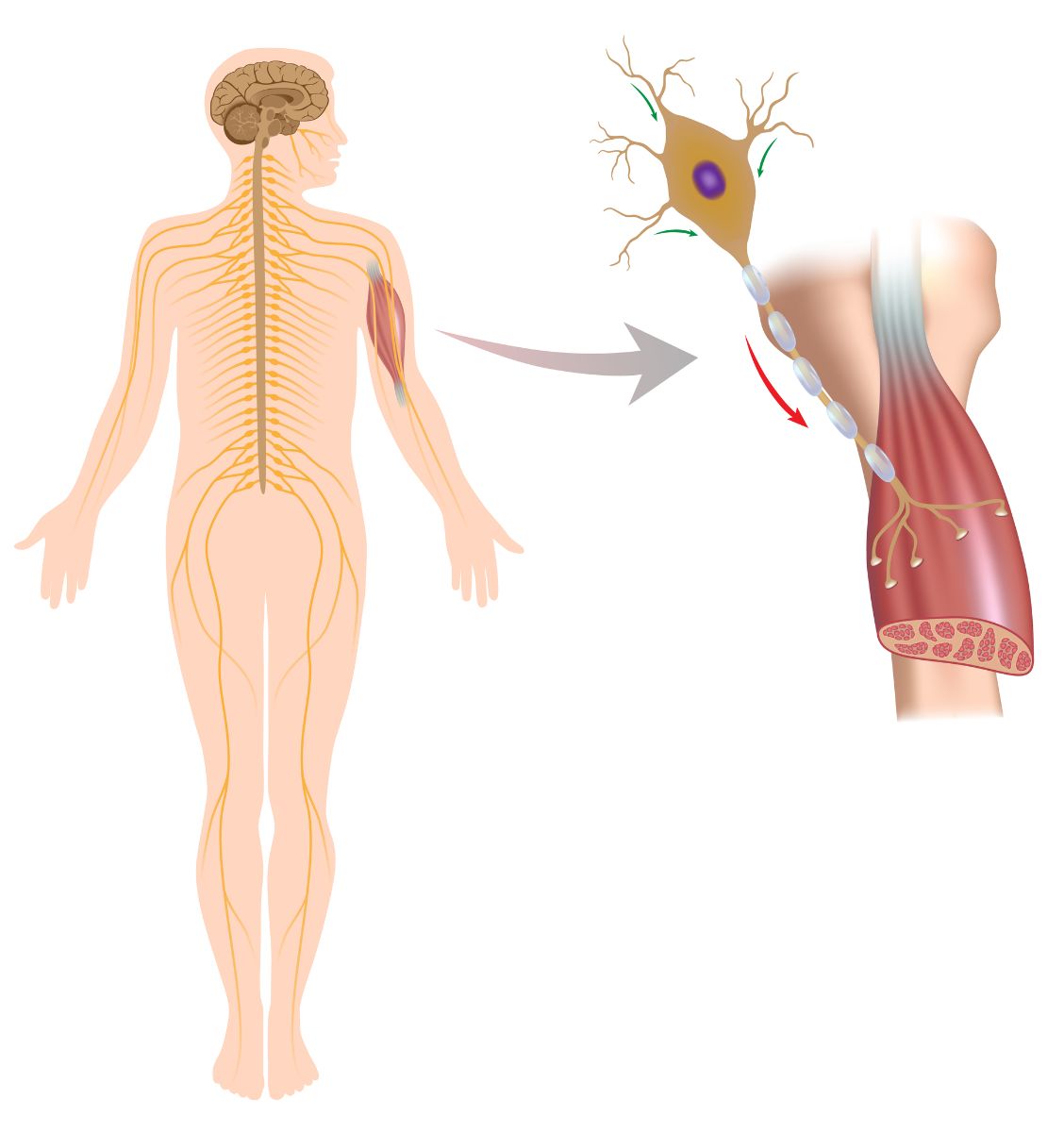 La esclerosis múltiple (EM) es una enfermedad inmunológica y degenerativa del sistema nervioso central, caracterizada por lesiones inflamatorias y desmielinizantes.