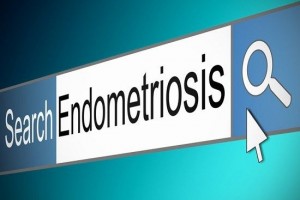Las adolescentes pueden padecer endometriosis sin saberlo.