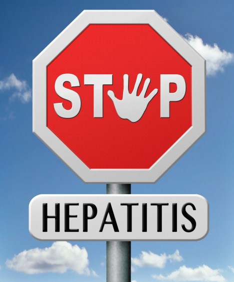 La hepatitis C afecta a alrededor de 1.6 millones de personas en México y a escala global mueren 350,000 personas por causas atribuibles a la enfermedad anualmente
