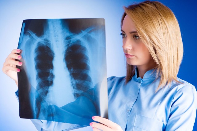 médica revisando radiografía 