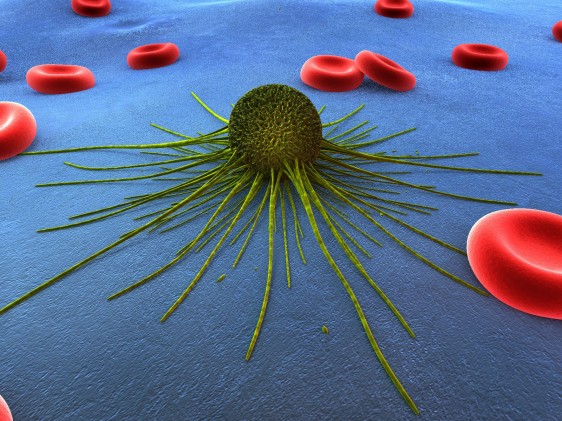 representación 3D de una celula de cáncer