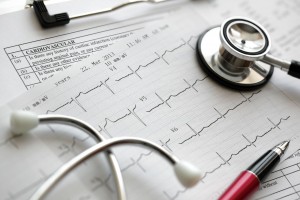 Estetoscopio y pluma sobre papeles con electrocardiograma y en otro papel la palabra cardiovascular impresa
