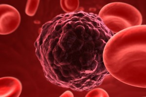 Ilustracion de una celula de cáncer entre globulos rojos
