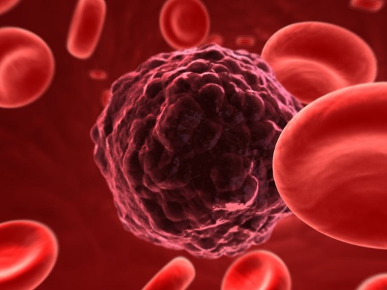 Ilustracion de una celula de cáncer entre globulos rojos