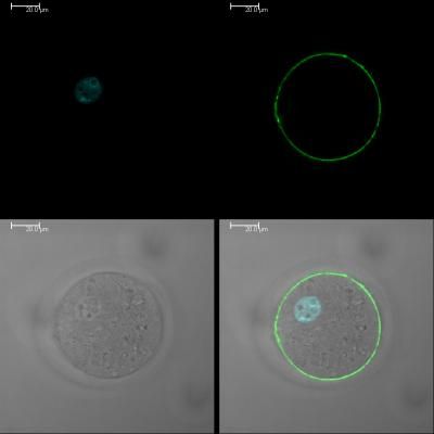 Muestra de inyección intracitoplasmática de espermatozoides (Intra-cytoplasmic sperm injection, ICSI) el verde es Juno, azul los pronúcleos