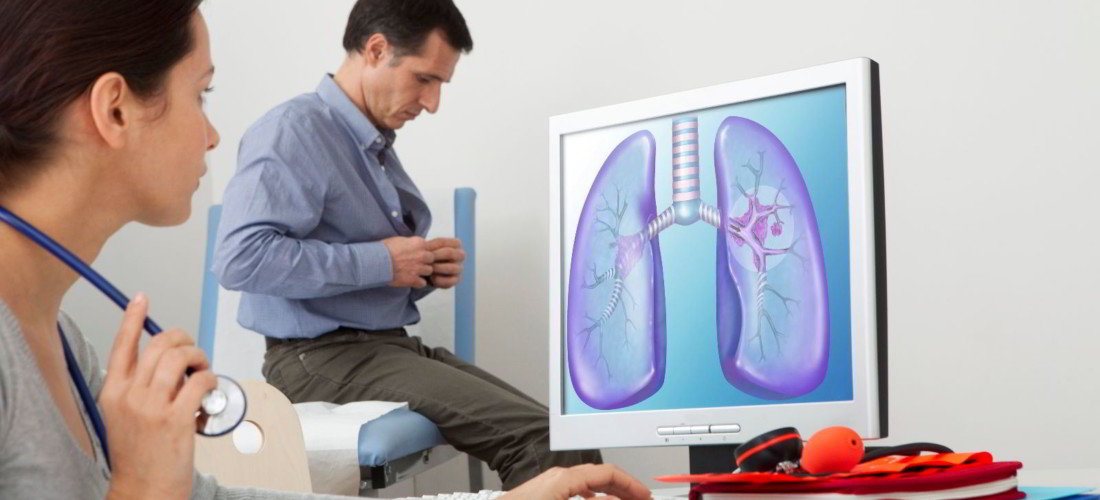 Doctora revisando imagen de pulmón atrás un paciente