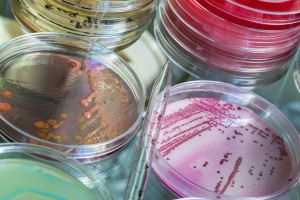 Muestras con bacterias para ser analizadas en un laboratorio