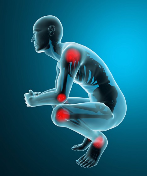 La artritis reumatoide causa severos dolores en hombros, codos, muñecas, tobillos, rodillas, es decir las principales articulaciones.