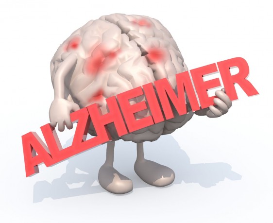 Ilustración de cerebro con pies y manos cargando letrero con la palabra "Alzheimer"