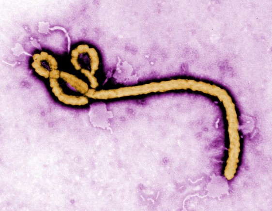 Imagen del Virus ébola
