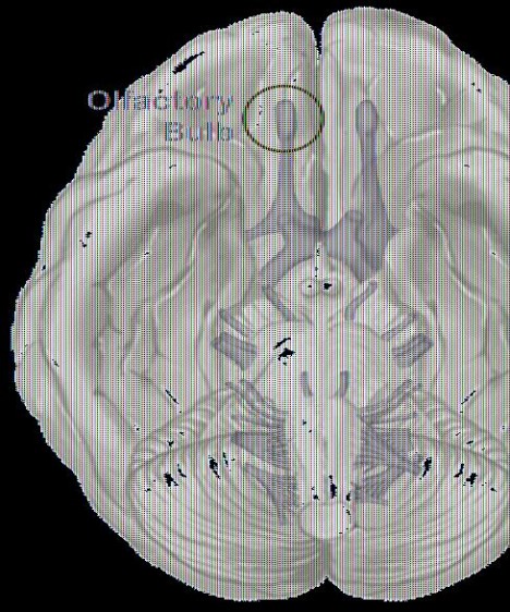 Ilustración de corte del cerebro