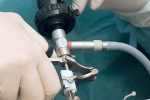 Acercamiento a las manos de un mésdico operando un aparato de laparoscópia