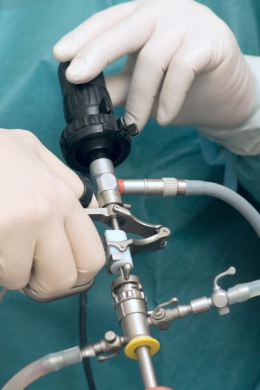 Acercamiento a las manos de un mésdico operando un aparato de laparoscópia