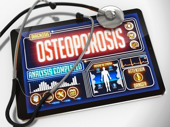 Estetoscopio ariba de una computadora de tableta con la palabra osteoporosis