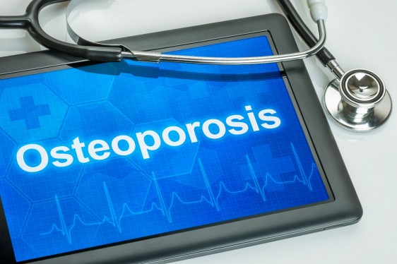 Computadora tablet con estetoscopio, en la pantalla de la tablet se encuentra la palabra "Osteoporosis"