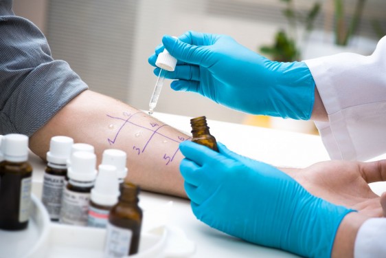 Médico aplica una prueba de alergia en el brazo de un paciente