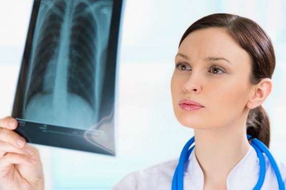 Doctora mirando a placa de pulmones fluorografía