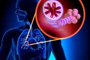 ilustración de un pulmón con acercamiento a bronquios cerrados