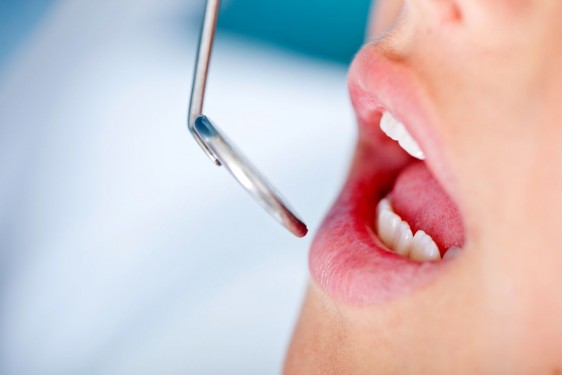 Acercamiento a la boca de un paciente con un espejo de dentista