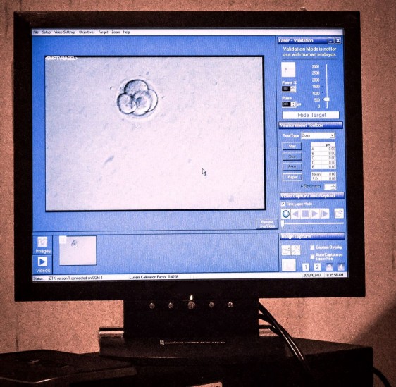 Monitor con imagen de las celulas de un embrión