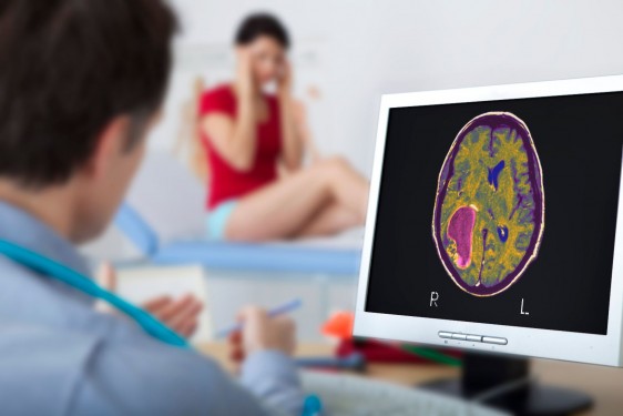 Consulta de neurología, médico observa panalla con cerebro al fondo una mujer