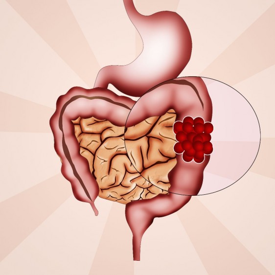 El colon es un conducto muscular que forma parte del aparato digestivo