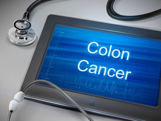 Computadora tablet con la palabra "Colon Cancer" y un estetoscopio