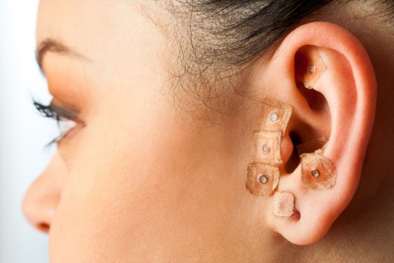Acercamiento al oído de una mujer con auriculoterapia