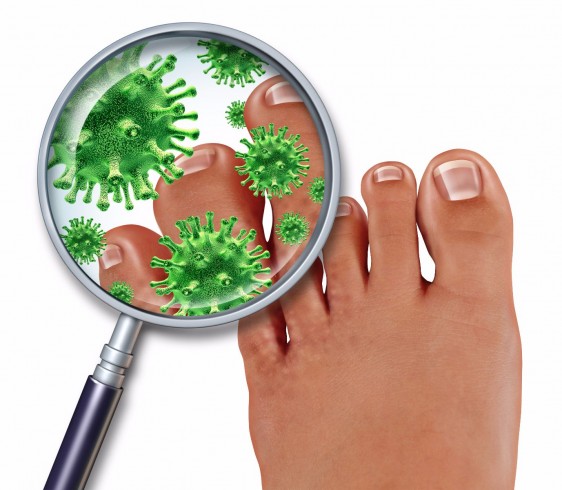  Los hongos en las uñas de los pies son una afección común que comienza como una mancha blanca o amarilla en la punta de una de ellas. A medida que la infección se vuelve más profunda, los hongos pueden provocar decoloración, engrosamiento o desmoronamiento en el borde de la uña.