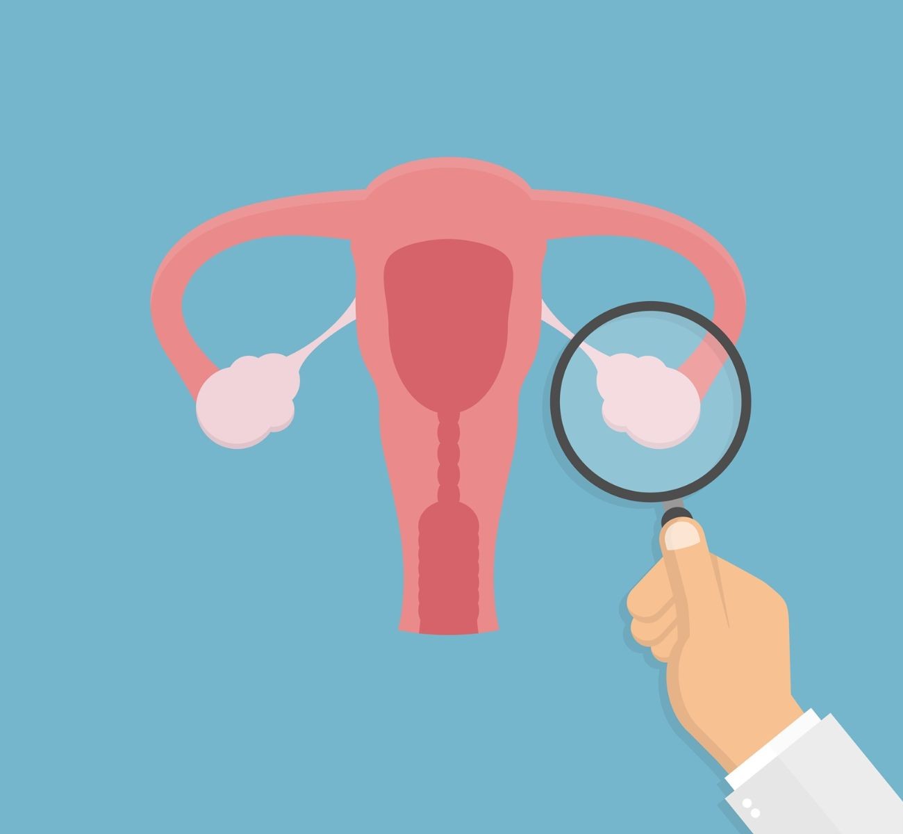 ilustración de inspección de ovarios