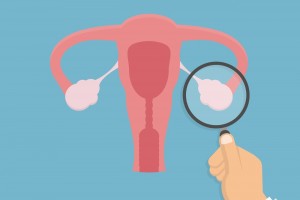 ilustración de inspección de ovarios