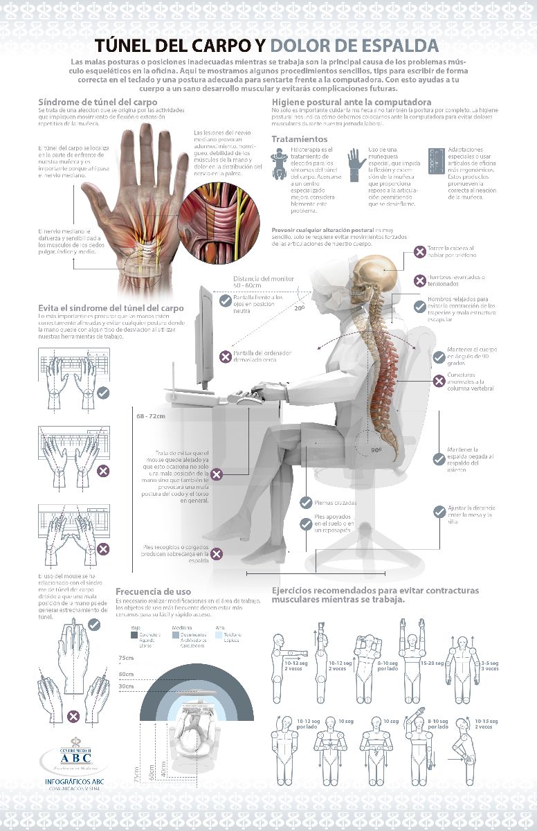 infografía acerca del Síndrome del túnel del carpo y Dolor de espalda