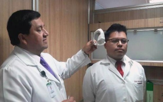 Con apoyo de la UNAM se realizó la prótesis cerebral en una impresora Estereolitográfica 3D.