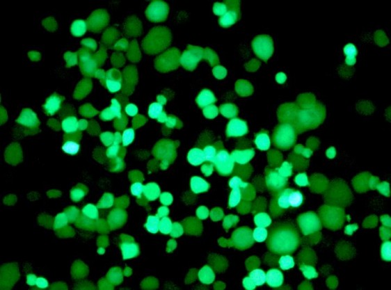 Observación del quinto día de células de un tumor infectados por el virus que se expresan con una proteína fluorescente.