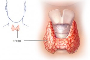 tiroides