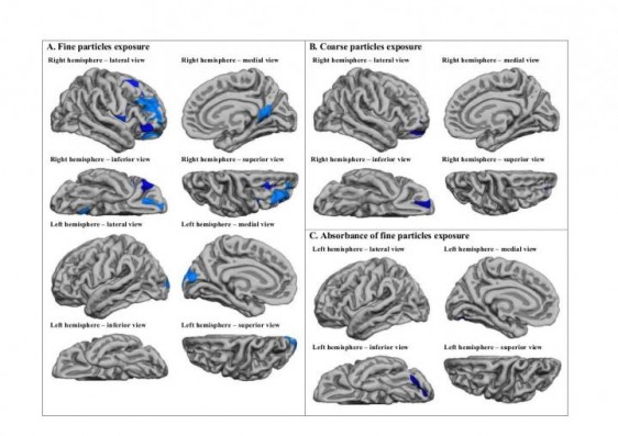 Imagen que muestra las regiones del cerebro afectadas por las partÃ­culas finas y gruesas.