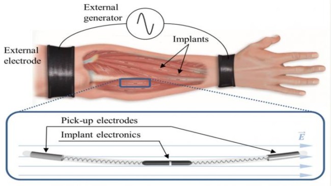 nuevo método de transmisión inalámbrica de potencia para implantes electrónicos inyectables