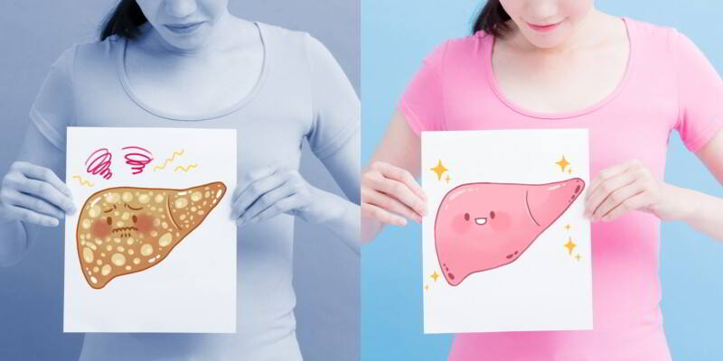 Mujer sosteniendo ilustraciones de higado uno graso otro sano