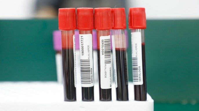 Tubos de ensayos para pruebas de sangre
