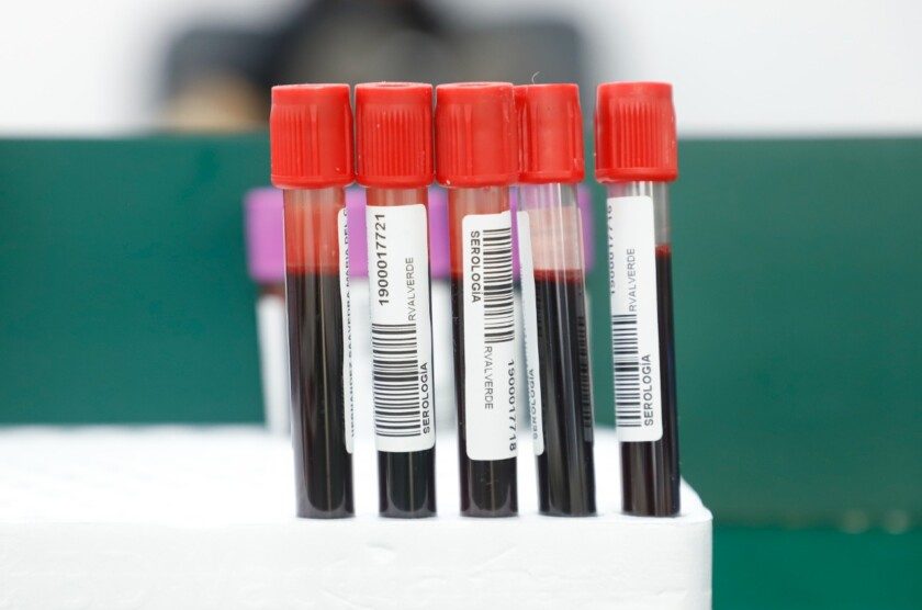 Tubos de ensayos para pruebas de sangre
