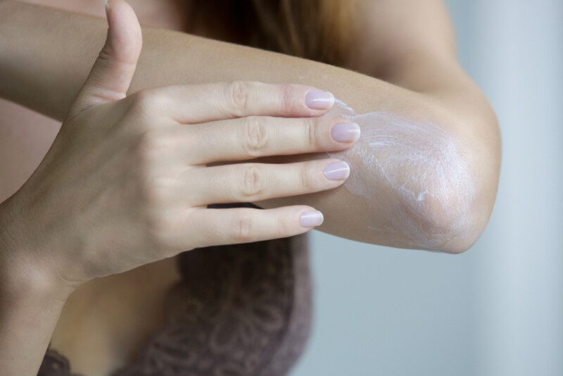 Mujer aplicando crema de codo.