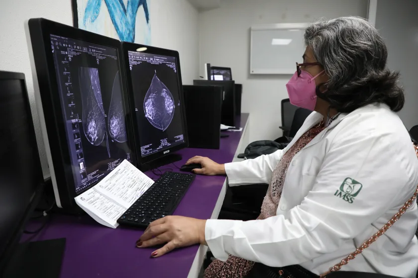 Especialista trbajando en tratamientos especializados para el cáncer de mama metastásica