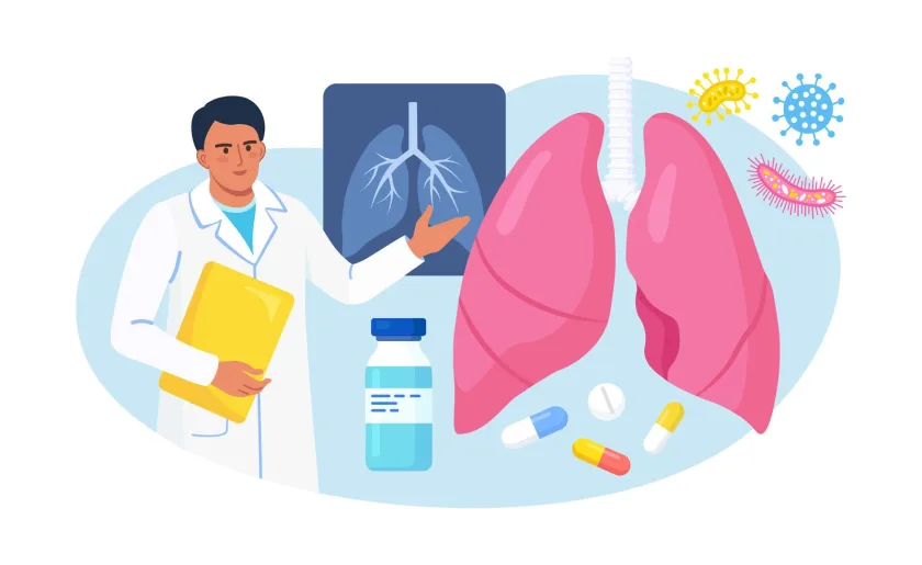 Ilustración para comprender mejor el cáncer de pulmón